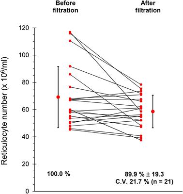 Membrane Rearrangements in the Maturation of Circulating Human Reticulocytes